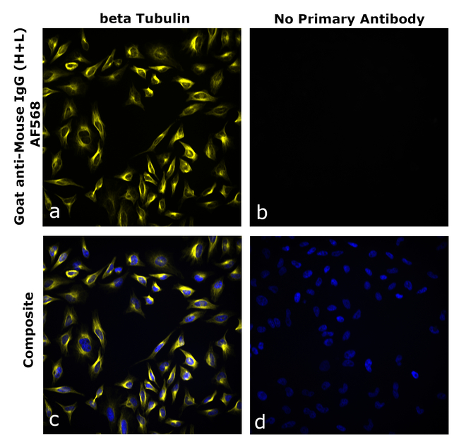 Mouse IgG (H+L) Secondary Antibody in Immunocytochemistry (ICC/IF)