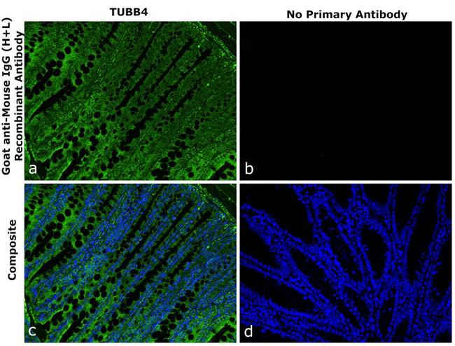 Mouse IgG (H+L) Secondary Antibody in Immunohistochemistry (Paraffin) (IHC (P))