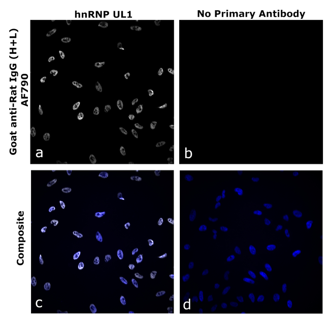 Rat IgG (H+L) Secondary Antibody in Immunocytochemistry (ICC/IF)
