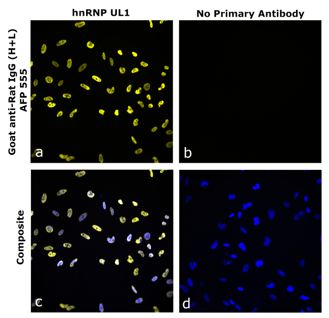 Rat IgG (H+L) Secondary Antibody in Immunocytochemistry (ICC/IF)