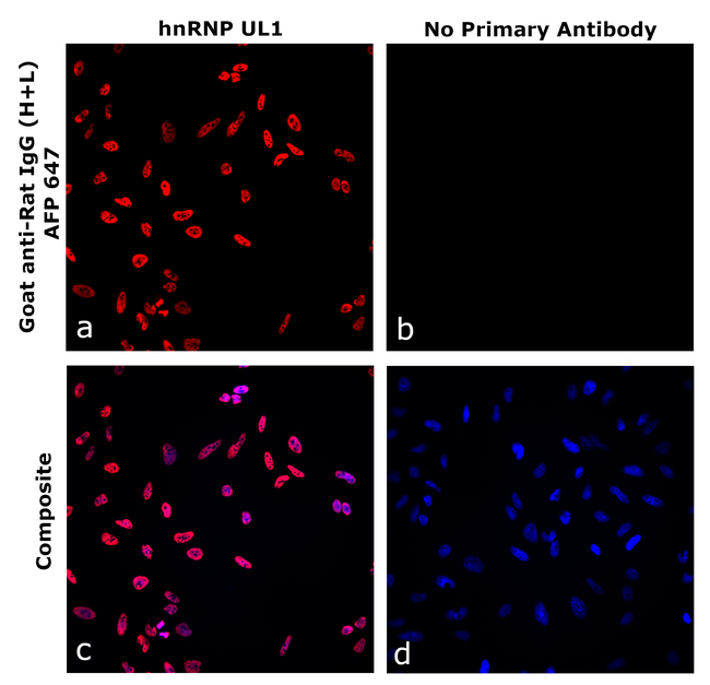 Rat IgG (H+L) Secondary Antibody in Immunocytochemistry (ICC/IF)