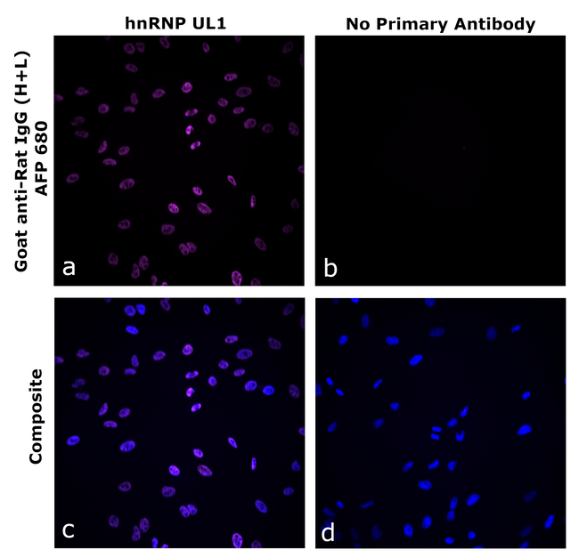 Rat IgG (H+L) Secondary Antibody in Immunocytochemistry (ICC/IF)