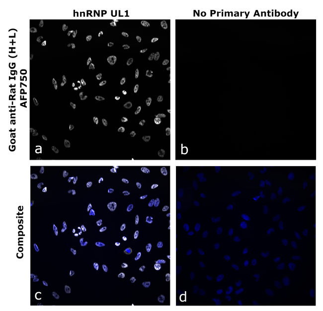 Rat IgG (H+L) Secondary Antibody in Immunocytochemistry (ICC/IF)