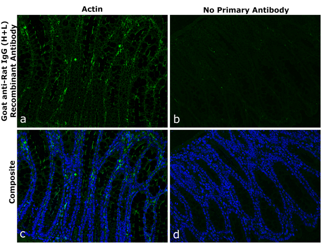 Rat IgG (H+L) Secondary Antibody in Immunohistochemistry (Paraffin) (IHC (P))