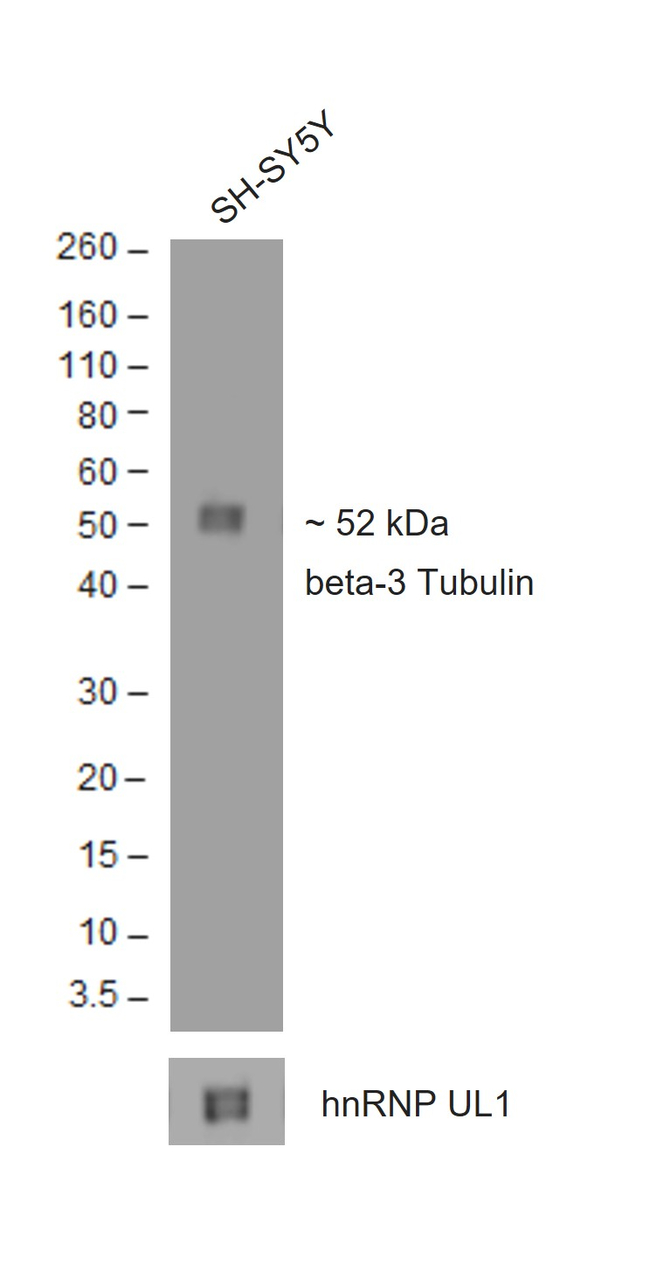 Mouse IgG (H+L) Secondary Antibody in Western Blot (WB)