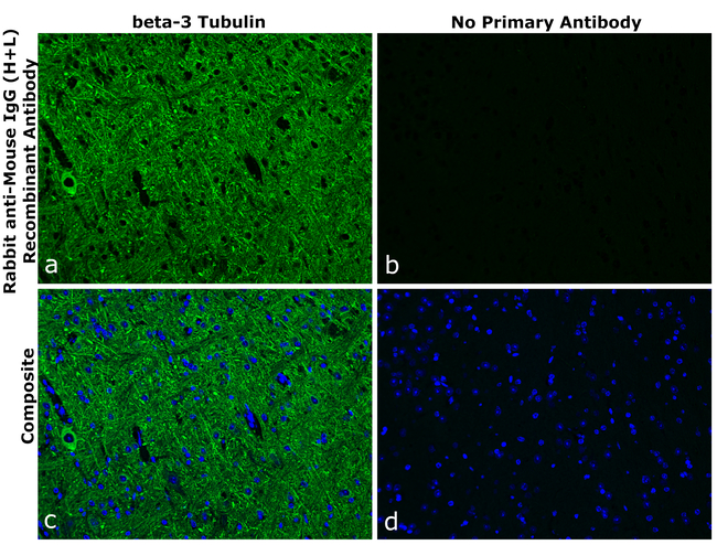 Mouse IgG (H+L) Secondary Antibody in Immunohistochemistry (Paraffin) (IHC (P))