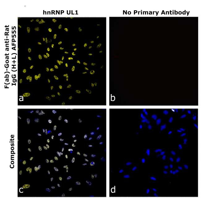 Rat IgG (H+L) Secondary Antibody in Immunocytochemistry (ICC/IF)