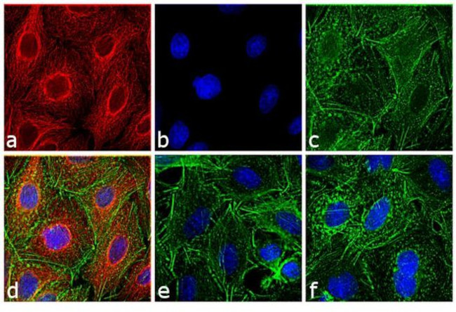 Rat IgG (H+L) Cross-Adsorbed Secondary Antibody in Immunocytochemistry (ICC/IF)