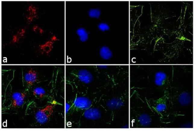 Rabbit IgG (H+L) Cross-Adsorbed Secondary Antibody in Immunocytochemistry (ICC/IF)