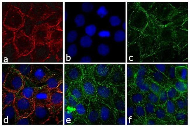 Rabbit IgG (H+L) Cross-Adsorbed Secondary Antibody in Immunocytochemistry (ICC/IF)