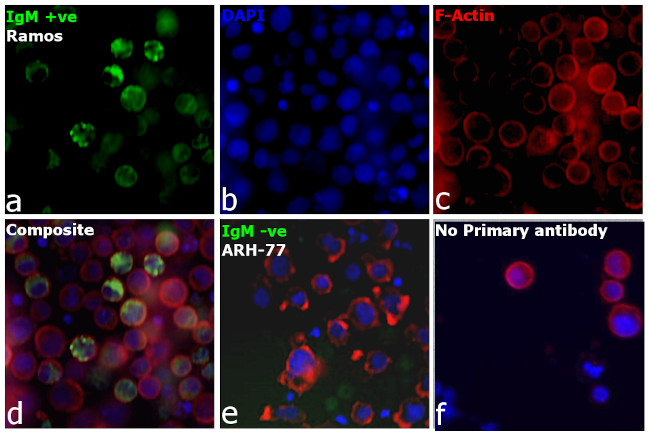 Human IgM Cross-Adsorbed Secondary Antibody in Immunocytochemistry (ICC/IF)