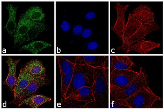 Mouse IgM Cross-Adsorbed Secondary Antibody in Immunocytochemistry (ICC/IF)