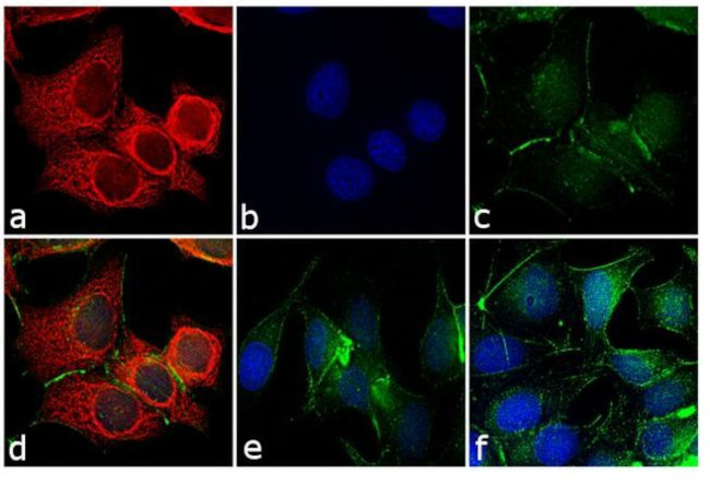 Mouse IgG (H+L) Cross-Adsorbed Secondary Antibody in Immunocytochemistry (ICC/IF)