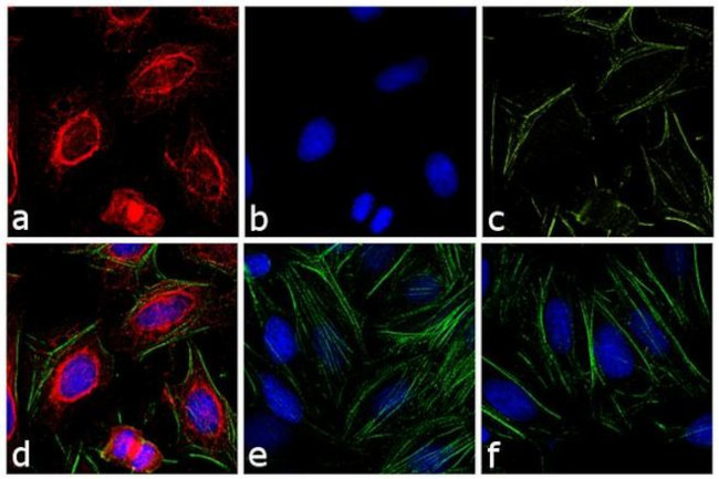 Mouse IgG (H+L) Cross-Adsorbed Secondary Antibody in Immunocytochemistry (ICC/IF)