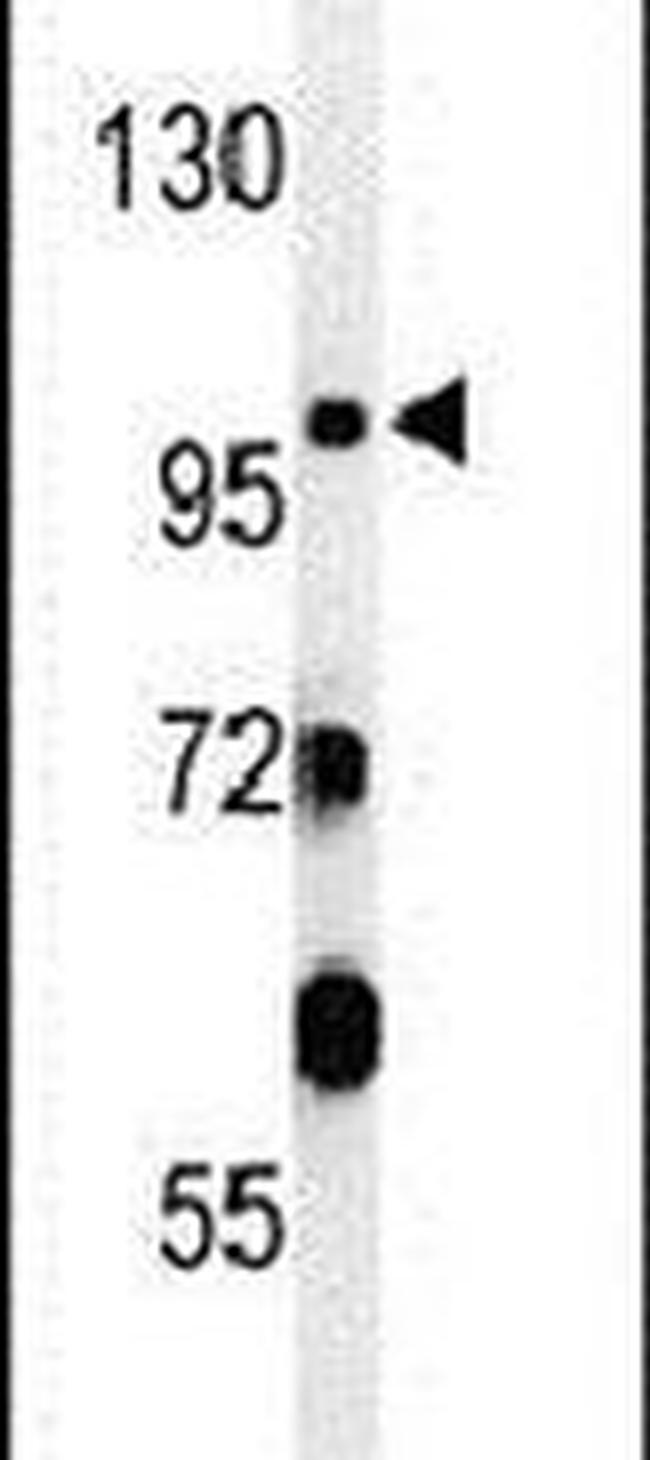 INPP5F Antibody in Western Blot (WB)
