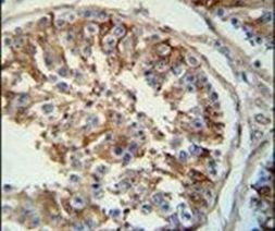 SPACA1 Antibody in Immunohistochemistry (IHC)