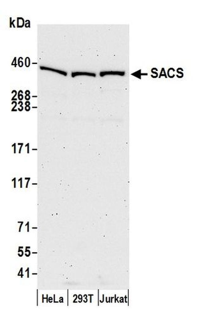 SACS Antibody in Western Blot (WB)