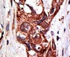 SAE1 Antibody in Immunohistochemistry (IHC)