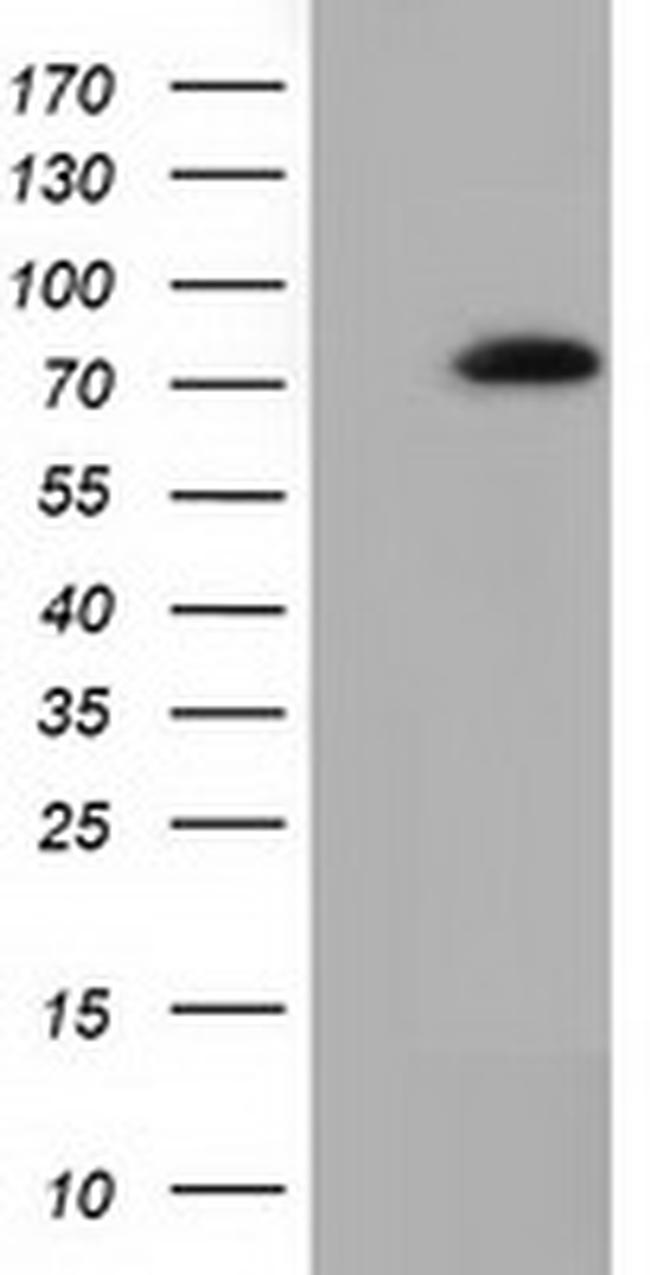 SAMHD1 Antibody in Western Blot (WB)