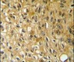 SAMSN1 Antibody in Immunohistochemistry (IHC)