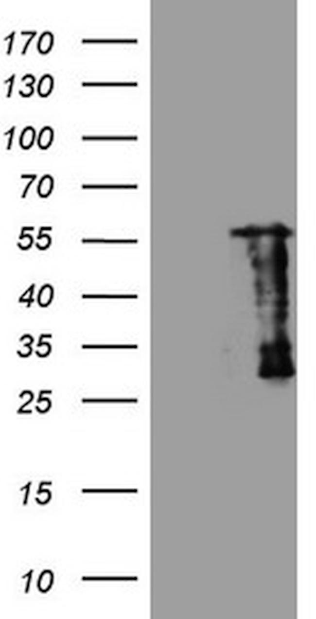 SAMSN1 Antibody in Western Blot (WB)