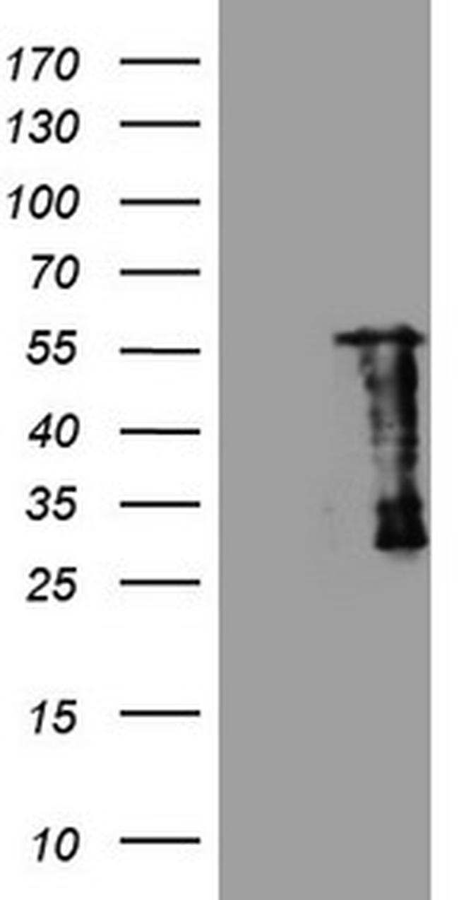 SAMSN1 Antibody in Western Blot (WB)