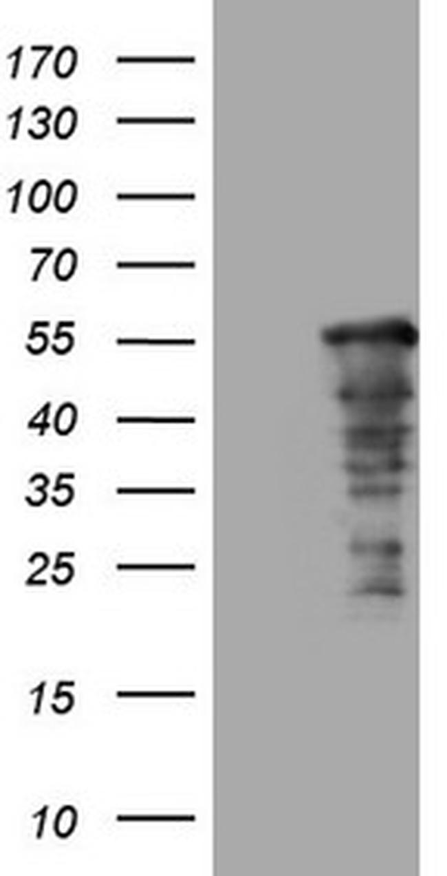 SAMSN1 Antibody in Western Blot (WB)