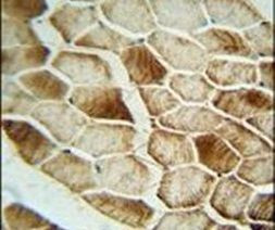 SAR1B Antibody in Immunohistochemistry (IHC)