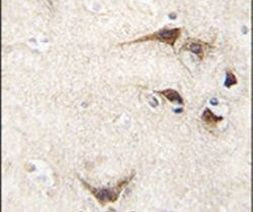 Seryl-tRNA synthetase Antibody in Immunohistochemistry (IHC)