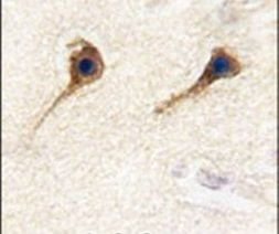 SARS2 Antibody in Immunohistochemistry (IHC)