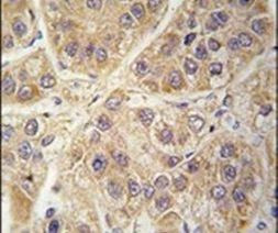 SARS2 Antibody in Immunohistochemistry (IHC)