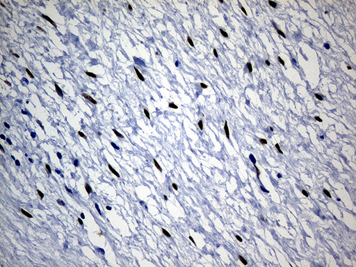 SATB2 Antibody in Immunohistochemistry (Paraffin) (IHC (P))