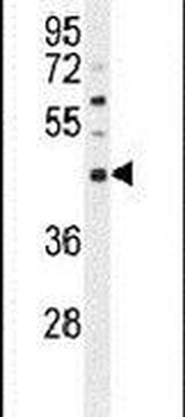 SATL1 Antibody in Western Blot (WB)