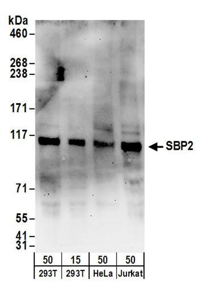 SBP2 Antibody in Western Blot (WB)