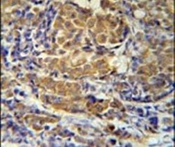 SBSN Antibody in Immunohistochemistry (IHC)