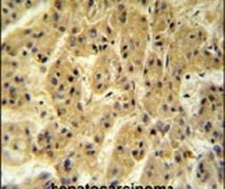 SEC24A Antibody in Immunohistochemistry (IHC)