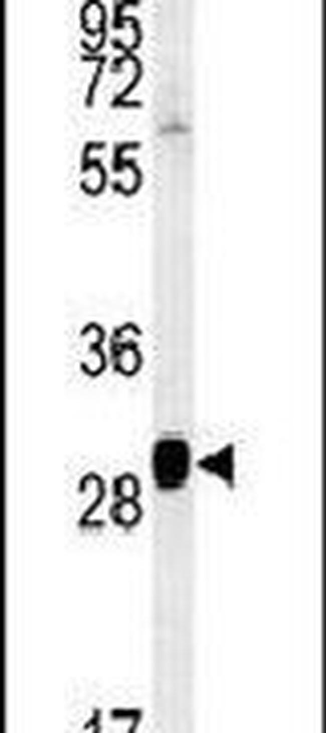SEC31B Antibody in Western Blot (WB)