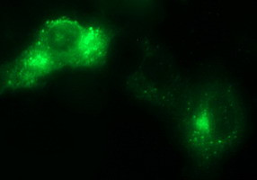 SCAMP2 Antibody in Immunocytochemistry (ICC/IF)