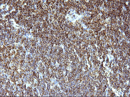 SCAMP2 Antibody in Immunohistochemistry (Paraffin) (IHC (P))