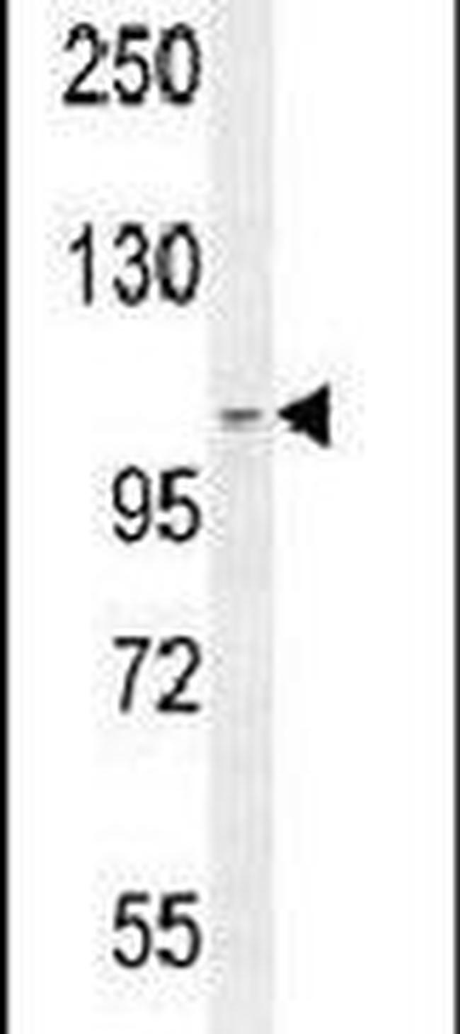 SCARF2 Antibody in Western Blot (WB)