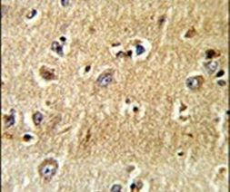 SCFD1 Antibody in Immunohistochemistry (IHC)