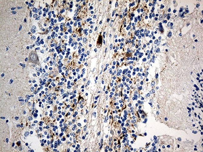 SCG2 Antibody in Immunohistochemistry (Paraffin) (IHC (P))