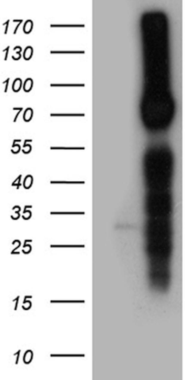 SCNN1A Antibody in Western Blot (WB)