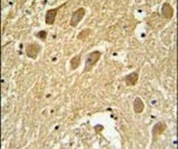 SCRN1 Antibody in Immunohistochemistry (IHC)