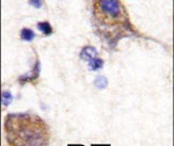 SCYL2 Antibody in Immunohistochemistry (IHC)
