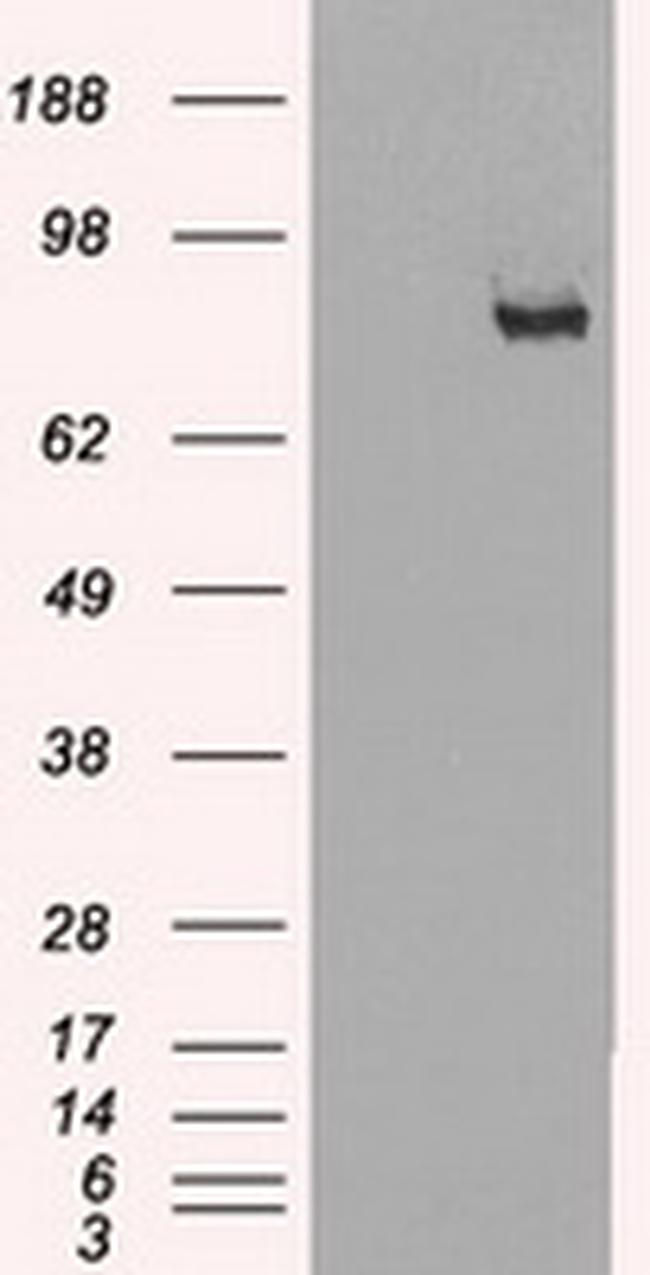 SCYL3 Antibody in Western Blot (WB)
