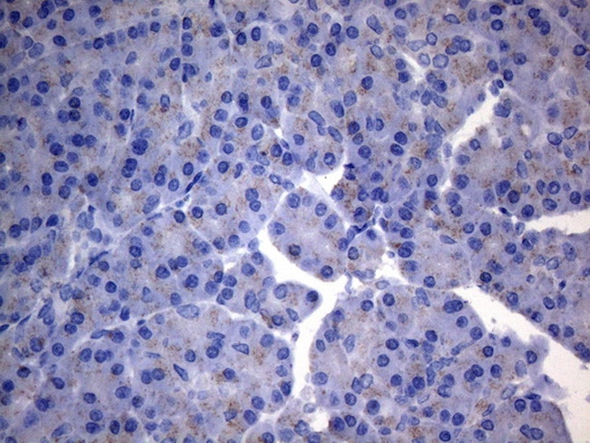 SDHB Antibody in Immunohistochemistry (Paraffin) (IHC (P))