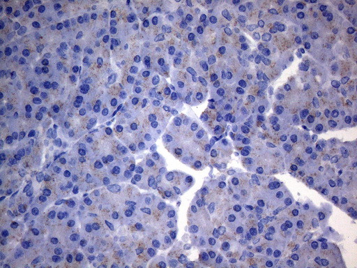 SDHB Antibody in Immunohistochemistry (Paraffin) (IHC (P))
