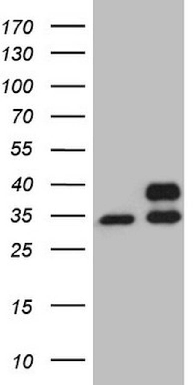 SDHB Antibody in Western Blot (WB)