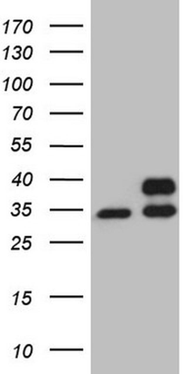 SDHB Antibody in Western Blot (WB)